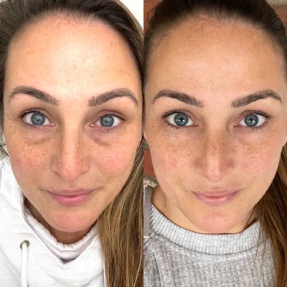 COPY - Collagen Elixir - Picture 10 of 11